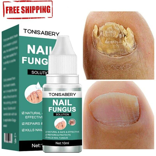 Nail Fungal Treatment Feet Care Essence Anti Infection
